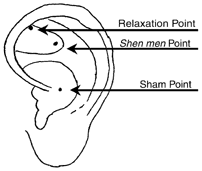 Ear Acupuncture Points Treating Anxiety - 