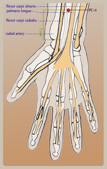 Pressure Point P-6 for Endometriosis Nausea